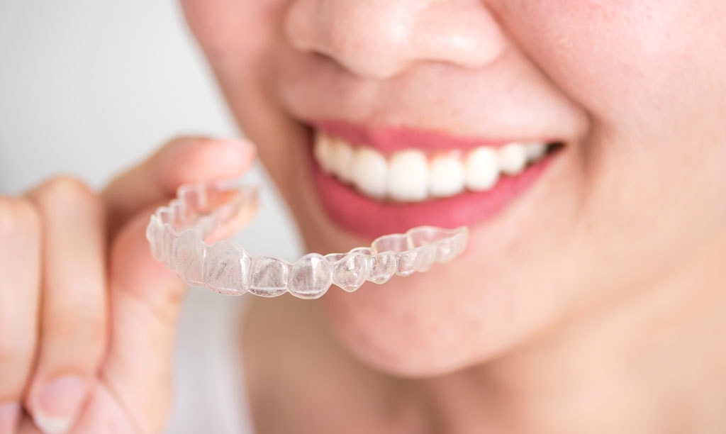 A smiling woman holding invisalign or invisible braces, orthodon