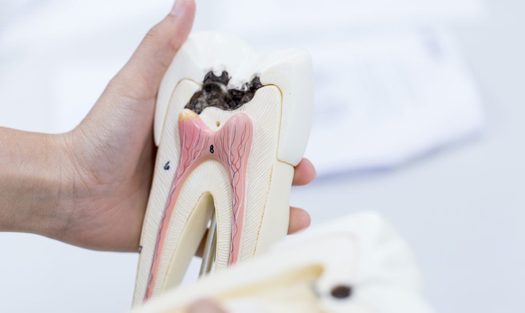 Tooth model for education in laboratory.