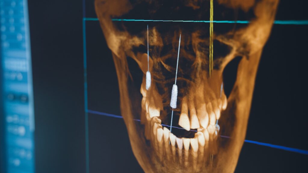 Zahnärztliche Röntgenaufnahme auf einem digitalen Bildschirm in einer Zahnklinik